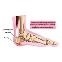 Plantilla Pie 4d Talla Ajustable