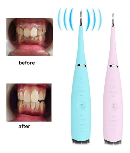 Eliminador de Sarro Dental Recargable